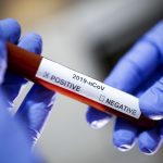 Van 45 casos de contagio