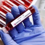 Acelerado incremento de casos de COVID-19