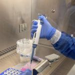 Un hombre que reside en Cartago fue confirmado como primer caso de viruela símica en el Valle del Cauca